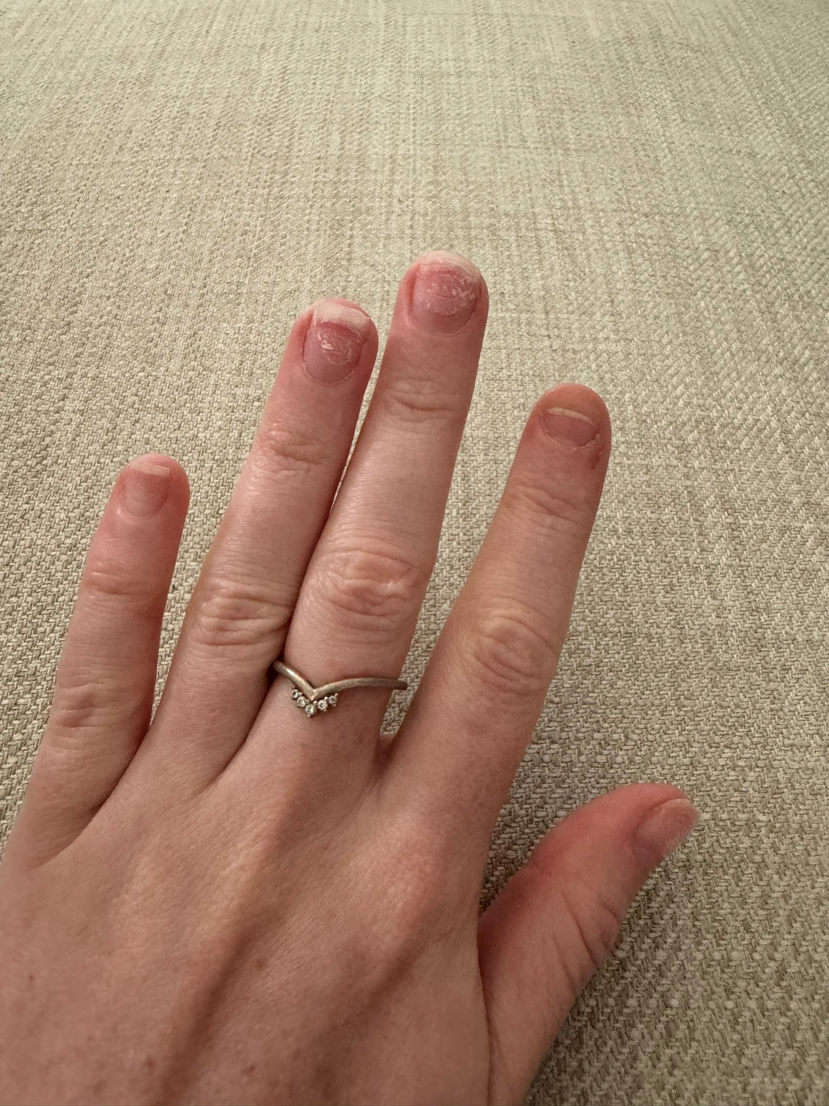 My own nails at week 1 of the grow-back, 26 January 2024
