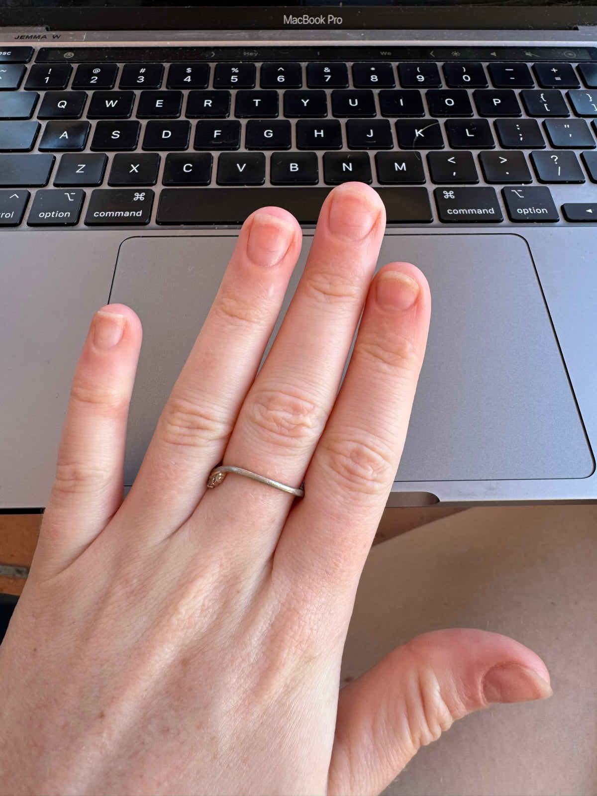 My own nails at week 5 of the grow-back, 29 February 2024